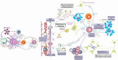 Interleukin-17 in Chronic Inflammatory Neurological Diseases